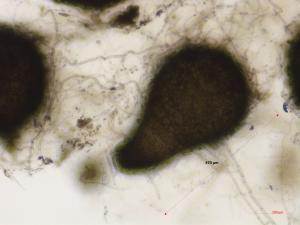 Sordaria_sp_4