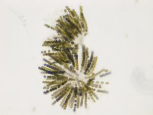 Sordaria_sp_5