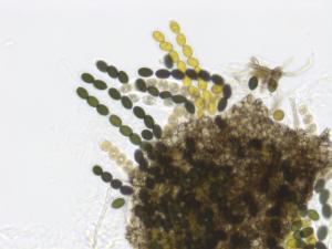 Sordaria_sp_6
