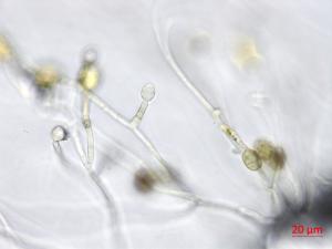 Ulocladium_sp_3