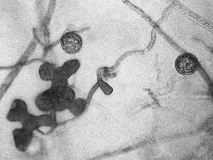 Pythium_torulosum_1