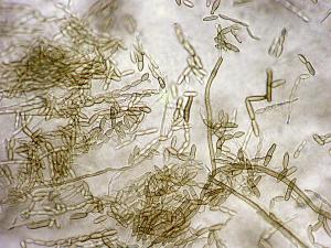 Ramularia_sp_2