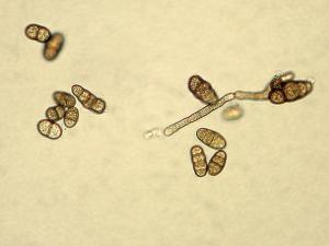 Ulocladium_sp_5