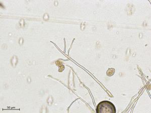 Phytophthora_infestans_3