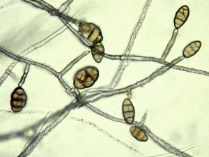 Alternaria_radicina_1