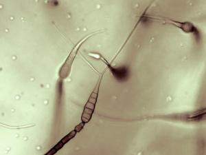 Alternaria_cichorii_5