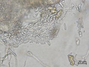 Ascochyta_sp_4