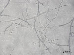 Aphanomyces_euteiches_1