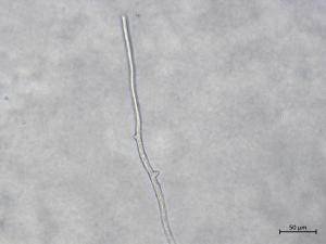 Aphanomyces_euteiches_3