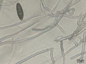 Bipolaris_sorokiniana_2