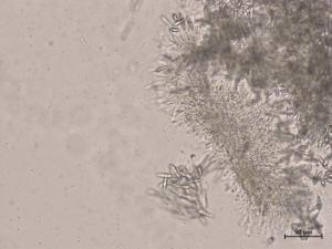 Botryosphaeria_dothidea_1