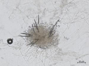 Colletotrichum_siamense_3