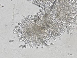 Colletotrichum_siamense_4