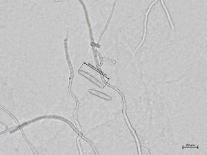 Dactylonectria_torresensis_1