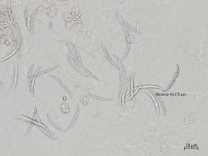 Fusarium_oxysporum_6