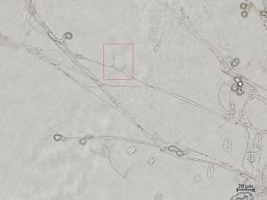 Fusarium_oxysporum_10