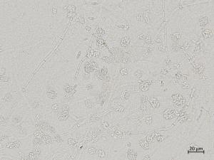 Plectosphaerella_cucumerina_2