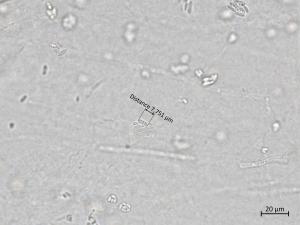 Plectosphaerella_cucumerina_3