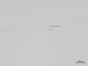 Plectosphaerella_cucumerina_4