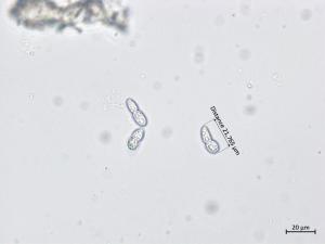 Diplocarpon coronariae