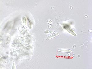 Botryosphaeria_sp_2
