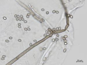 Botrytis_sp_3