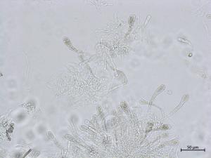 Chaetomium_sp_4