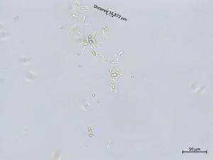 Colletotrichum_boninense_1