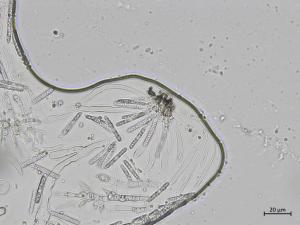 Coleophoma_empetri_1