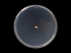 Diplocarpon_fragariae_1