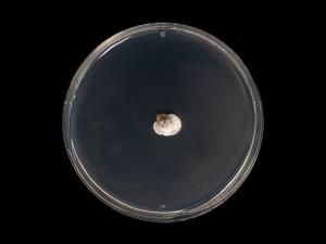 Diplocarpon_fragariae_3