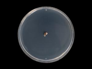 Diplocarpon_fragariae_4