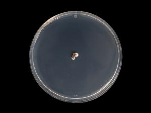 Diplocarpon_fragariae_5