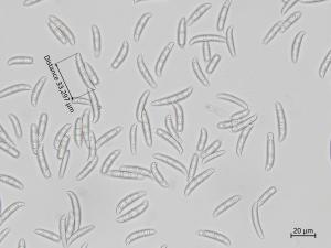 Fusarium_sambucinum_6