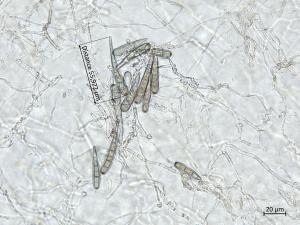 Helminthosporium_solani_7