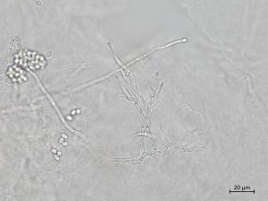 Ilyonectria_liriodendri_1