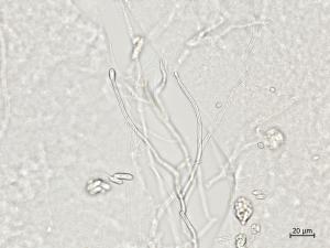 Ilyonectria_liriodendri_2