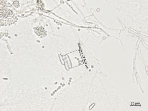 Ilyonectria_liriodendri_3