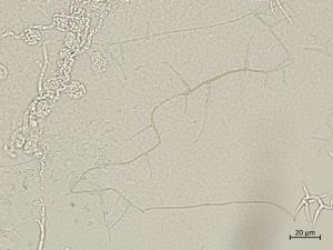 Phaeoacremonium_minimum_7