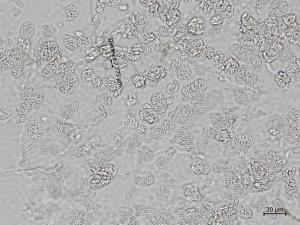 Cadophora_luteo-olivacea_7
