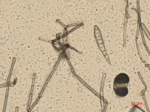 Corynespora_sp_1