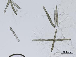 Corynespora_sp_3