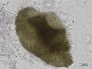 Cytospora_chrysosperma_7