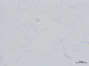 Diaporthe_sp_4