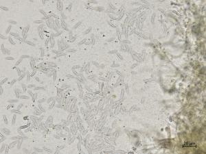 Fusarium_sp_2