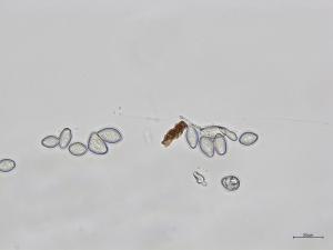 Monilinia_fructicola_2