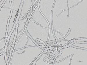 Monilinia_polystroma_1