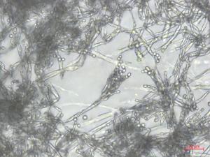 Penicillium_expansum_1