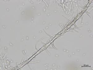 Phaeoacremonium_fraxinopennsylvanicum_2