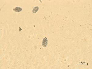Phytophthora_infestans_2